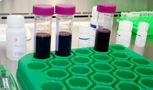 Photo by Leslie Mertz. Although WineSeq was launched just a year ago, Biome Makers has already processed more than 3,000 soil samples from 200 client vineyards and wineries worldwide, including 120 in California.